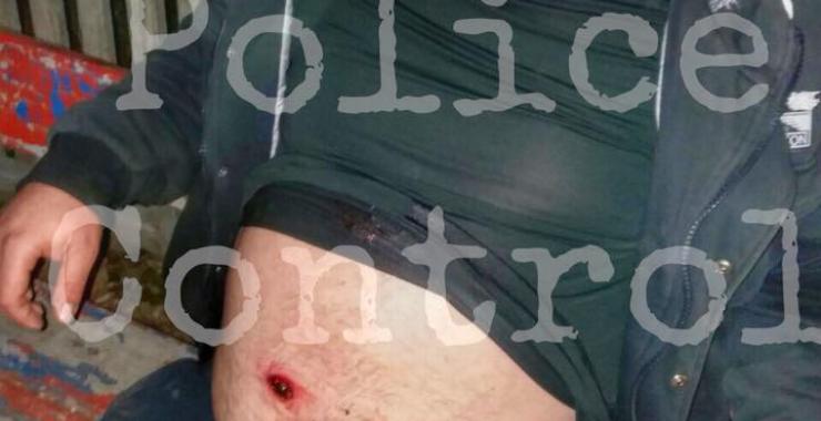 Стрельба в Харькове. Фото: facebook.com/policecontrolukraine