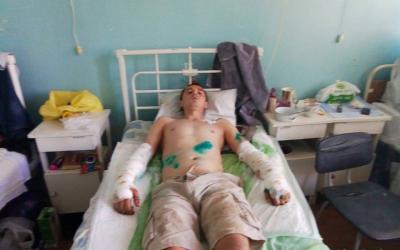 Пострадавший от нападения питбулей в Дергачах. Фото: Подслушано Дергачёвский район / facebook.com