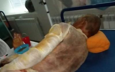 Харьковские медики борются за жизнь мальчика, спасшего дедушку из огня. Фото: Ирина Сорокина